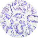 Control Slides, IHC - ARID1A