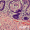 The H&E Stain: Far From Routine Part 2