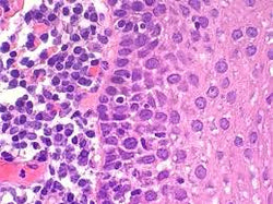 The H&E Stain: Far From Routine Part 1