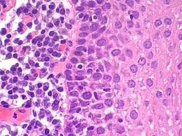 The H&E Stain: Far From Routine Part 1