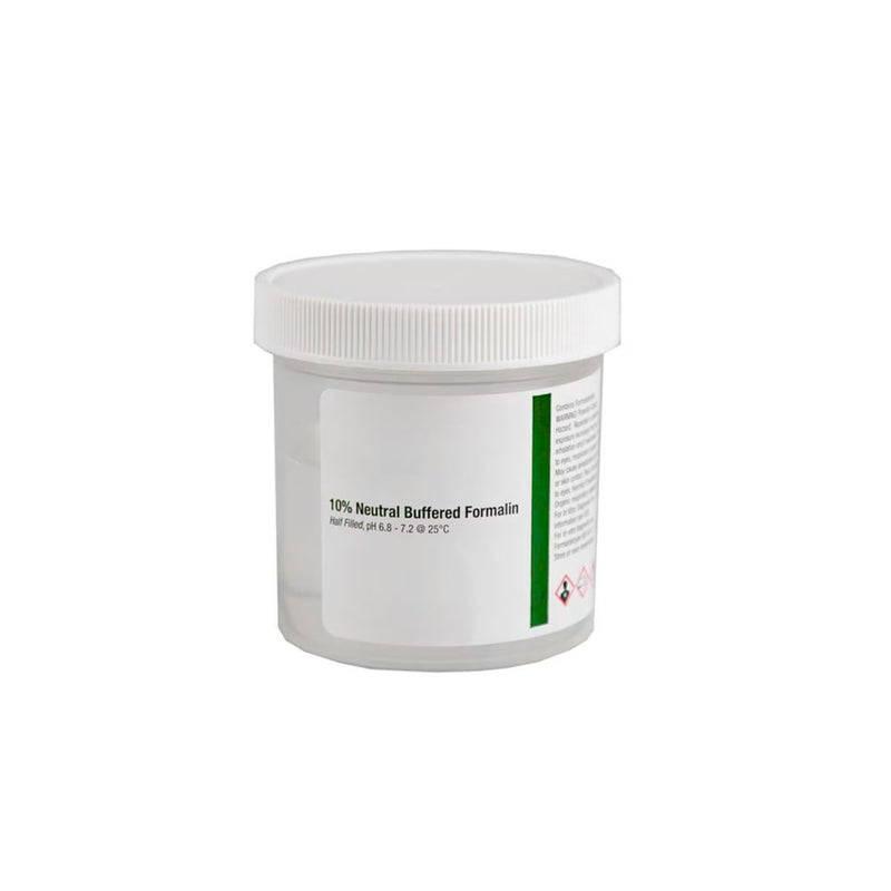 Large Pre-Filled Formalin Jars