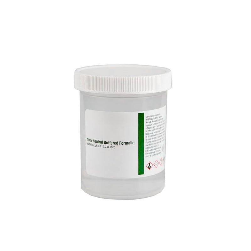 Large Pre-Filled Formalin Jars