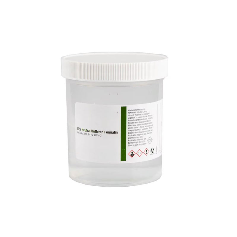 Large Pre-Filled Formalin Jars