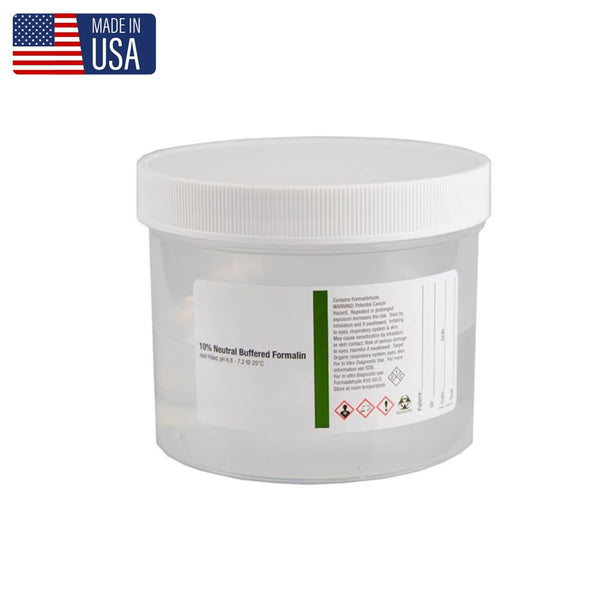 Large Pre-Filled Formalin Jars