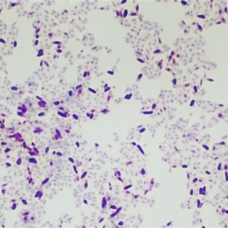 AFB Ziehl-Neelsen Stain Bundle (16oz)