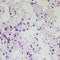 AFB Ziehl-Neelsen Stain Bundle