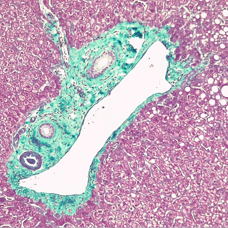 Gomori Trichrome Stain