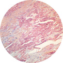 Control Slides, Special Stain - amyloid; Congo red stain