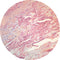 Control Slides, Special Stain - amyloid; Congo red stain