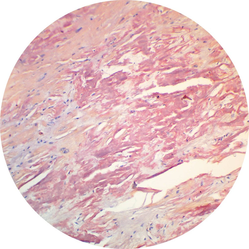Control Slides, Special Stain - amyloid; Congo red stain