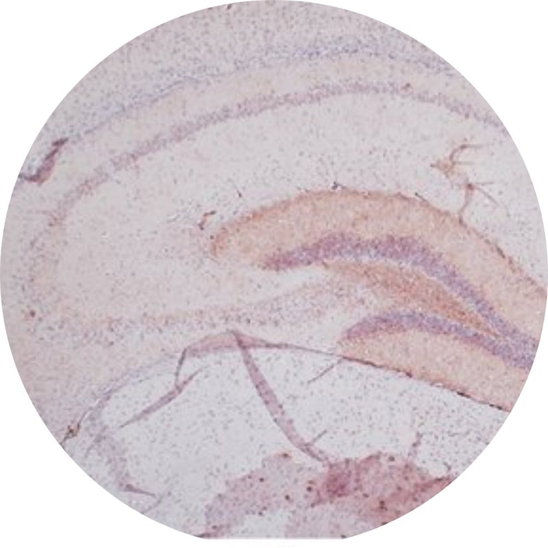 Control Slides, IHC - AT100