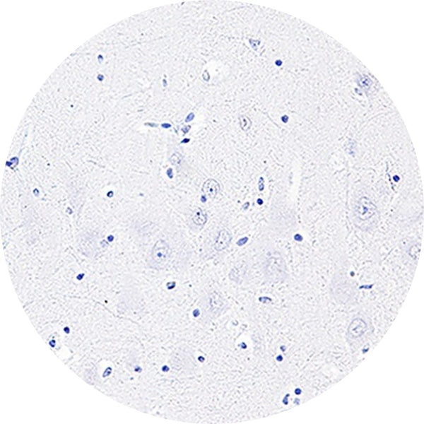 Control Slides, IHC - AT8