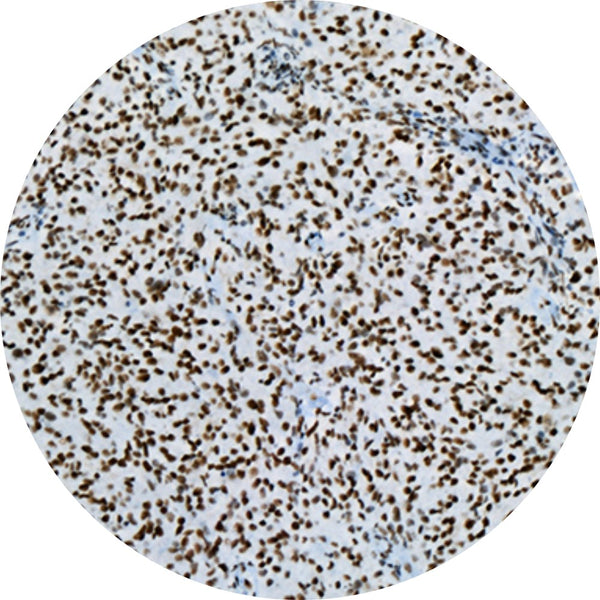 Control Slides, IHC - ATRX