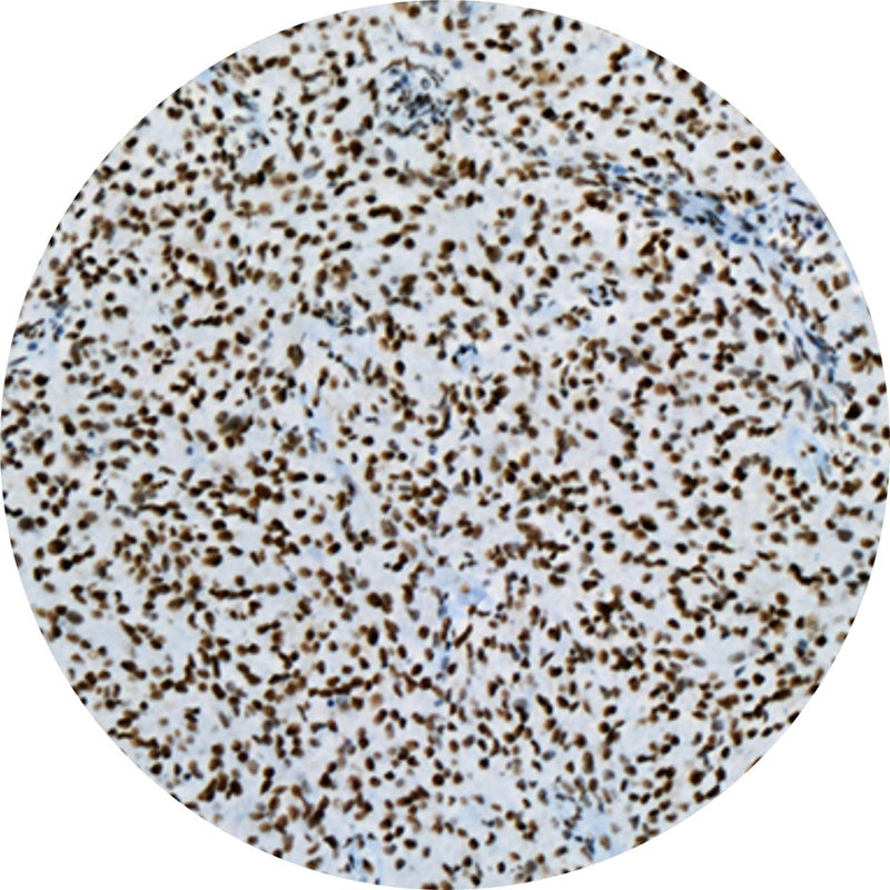 Control Slides, IHC - ATRX