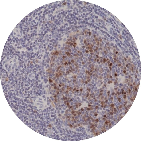 Control Slides, IHC - Aurora B
