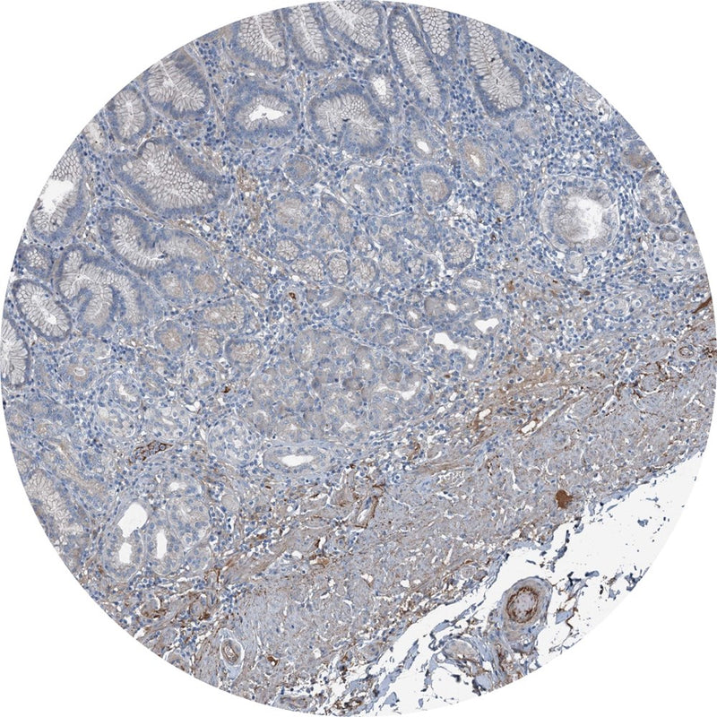 Control Slides, IHC - AXL