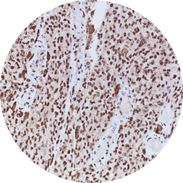Control Slides, IHC - BAP-1