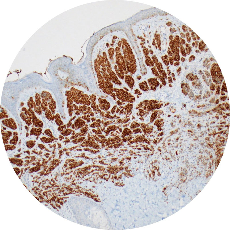 Control Slides, IHC - BRAF V600E