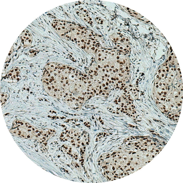 Control Slides, IHC - BRG1/SMARCA4