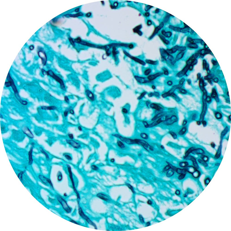 Control Slides, Special Stain - Candida sp.; GMS