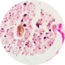 Control Slides, Special Stain - calcium; Von Kossa stain