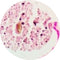 Control Slides, Special Stain - calcium; Von Kossa stain