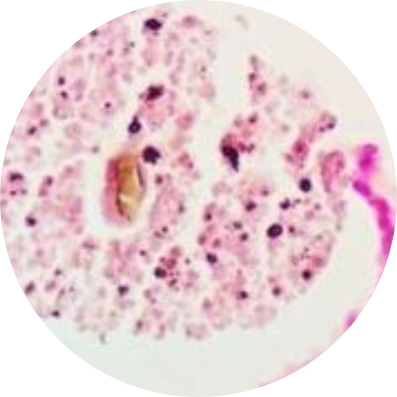 Control Slides, Special Stain - calcium; Von Kossa stain