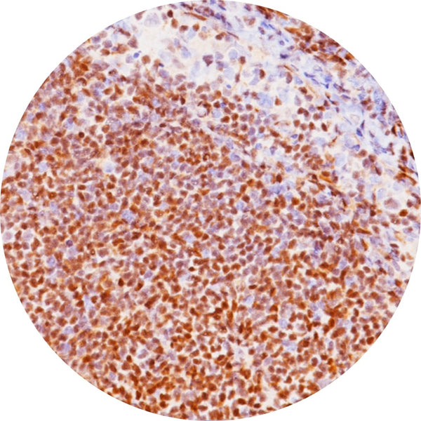 Control Slides, IHC - BCL 1