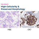 CytoPath Disc (PK/20)