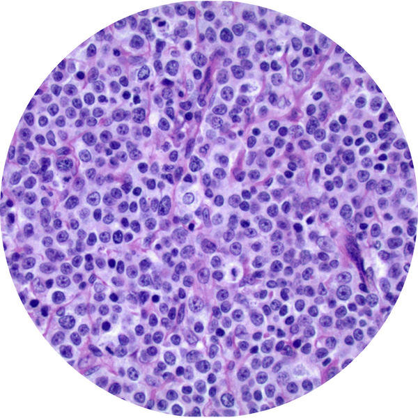 Control Slides, H&E - Human Lymph Nodes