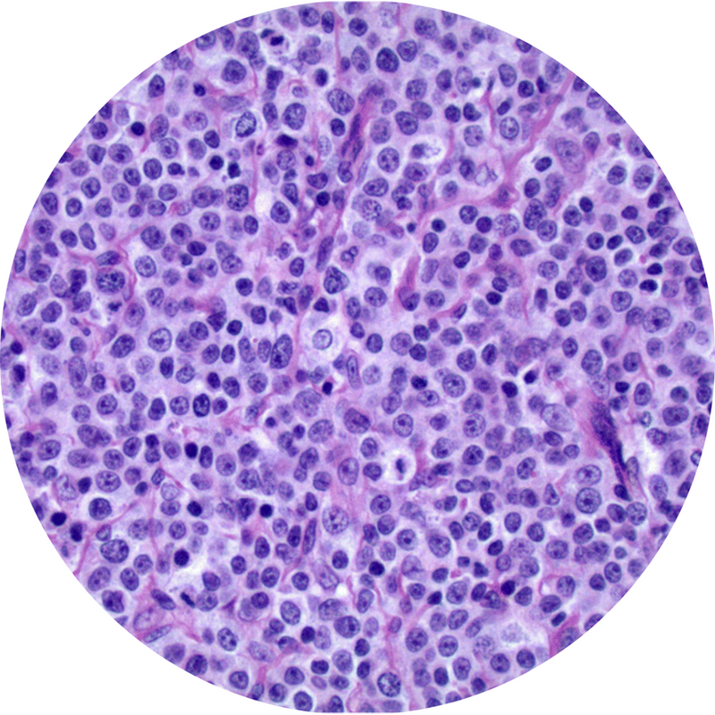 Control Slides, H&E - Human Lymph Nodes