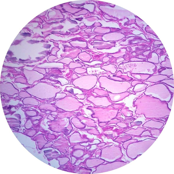 Control Slides, H&E - Human Thyroid