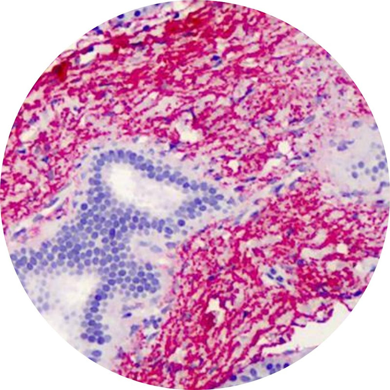 Control Slides, Special Stain - elastin; Verhoeff stain