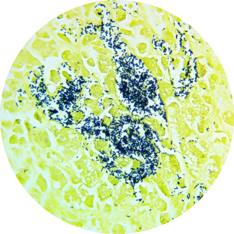 Control Slides, Special Stain - Gram+ stain