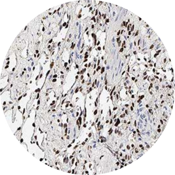 Control Slides, IHC - HHV8
