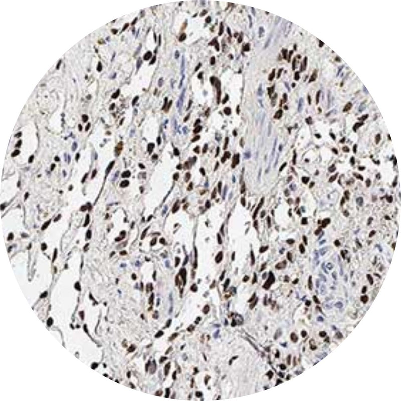 Control Slides, IHC - HHV8