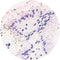 Control Slides, IHC H Pylori