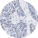 Control Slides, IHC - HPV high-risk