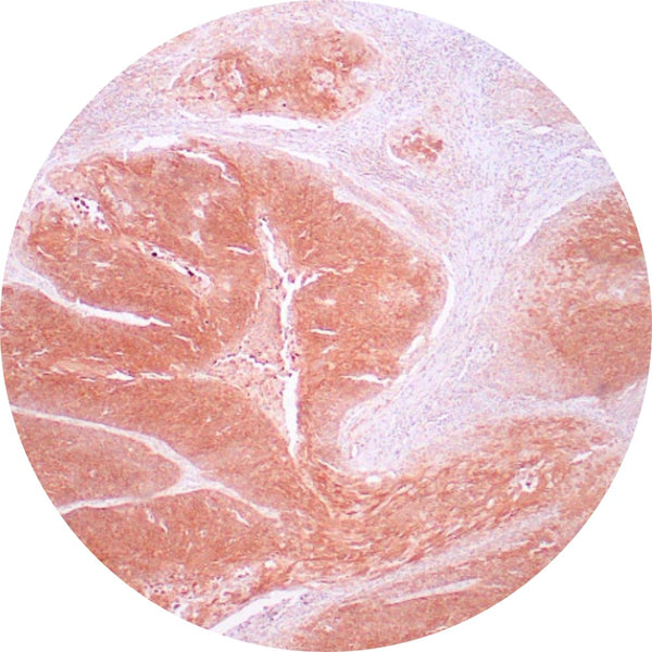 Control Slides, IHC - HPV low-risk
