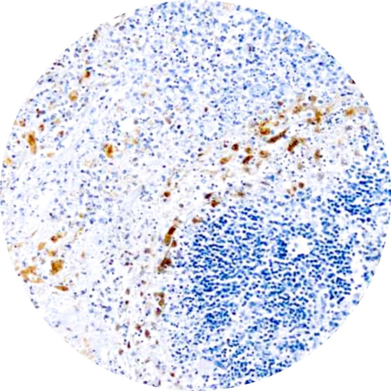 Control Slides, IHC - HSV Unspecified Suptype