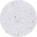 Control Slides, IHC - HSV Type 2 herpes simplex virus 2