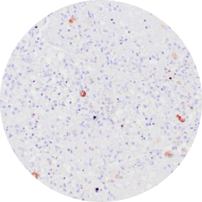 Control Slides, IHC - HSV Type 2 herpes simplex virus 2