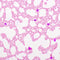 Hematology Stain Pack, Wright-Giemsa