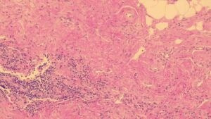 Gills 2 Hematoxylin