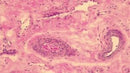 Modified Mayer's Hematoxylin