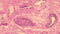 Mayer's Hematoxylin, Acidified