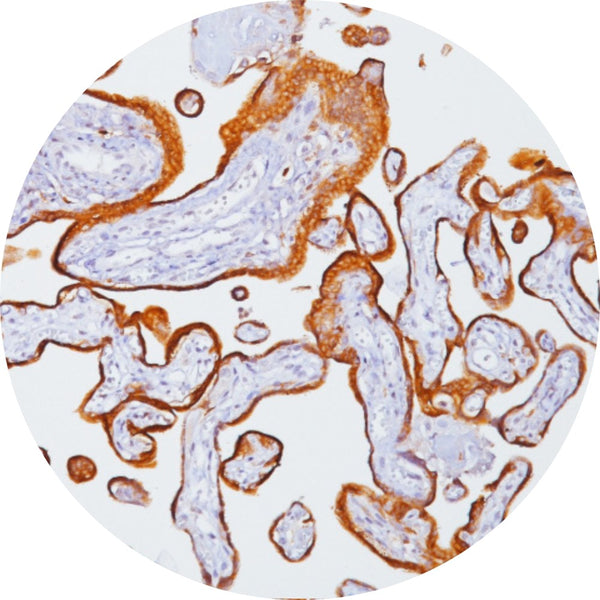 Control Slides, IHC - B-HCG