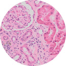Control Slides, Kidney