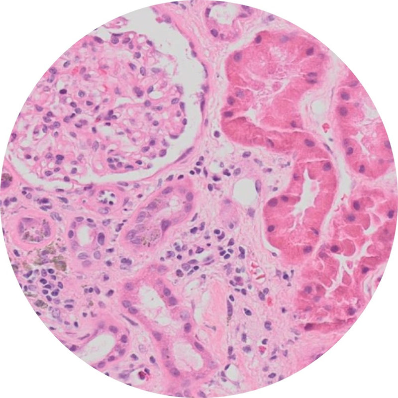 Control Slides, Kidney