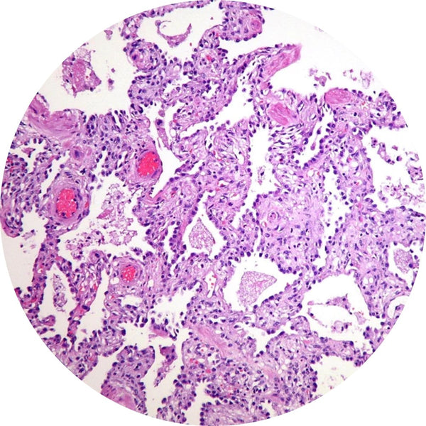 Control Slides, Lung